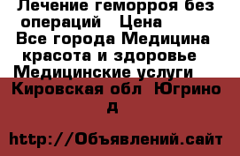 Лечение геморроя без операций › Цена ­ 300 - Все города Медицина, красота и здоровье » Медицинские услуги   . Кировская обл.,Югрино д.